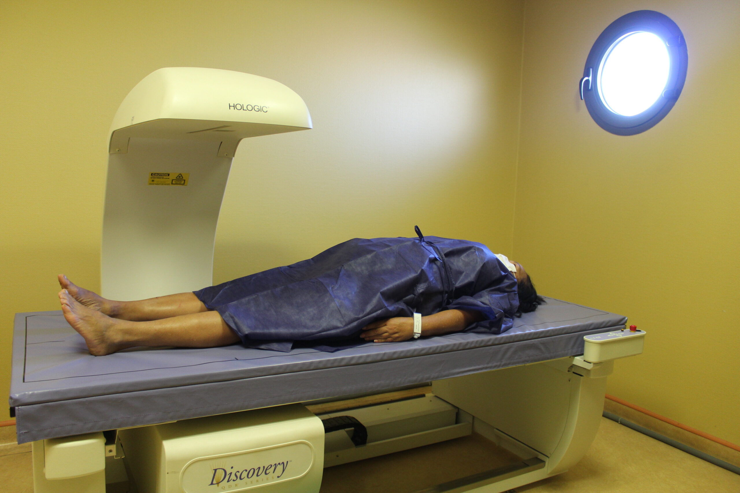 Dexa 1